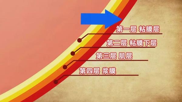 胃壁由四层组成