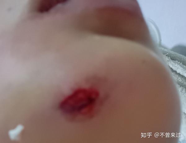 磕破 zhuanlan.zhihu.com