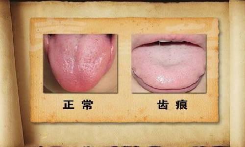 通常来说,正常的舌头,是淡红而润泽的,舌面上的舌苔,薄白而清静,干湿