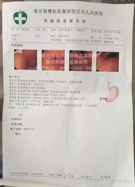 吞噬坏死脱落的息肉碎片,改变息肉性质,使恶性息肉转向良性发展,降低