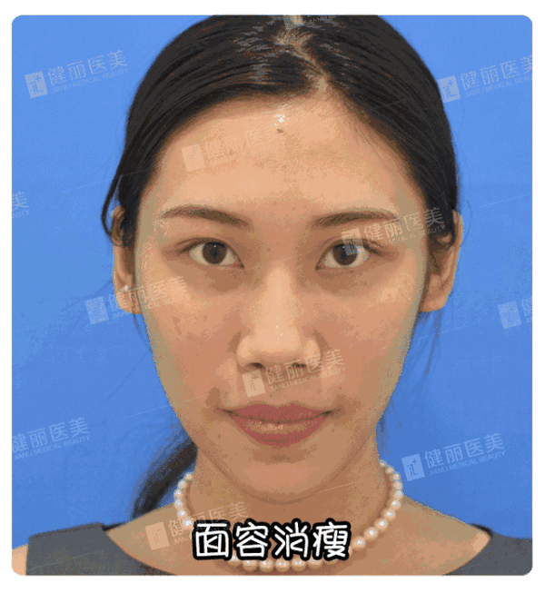 大家有没有发现,颜值高的女孩 面部似乎都有一个共同特征 然而,在