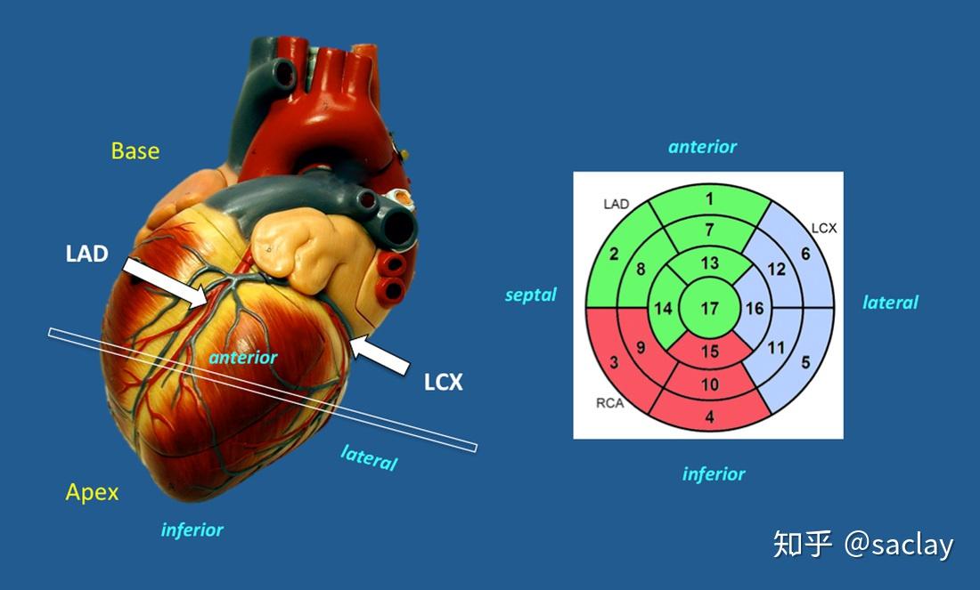心脏功能标记的位置环彩图是怎么回事