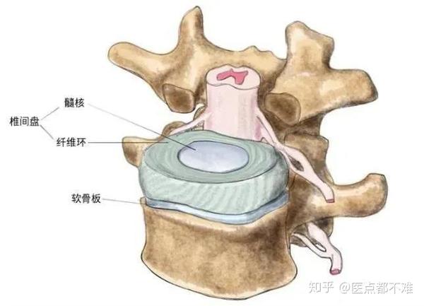 饱受腰椎间盘突出的困扰这个疗法你知道吗