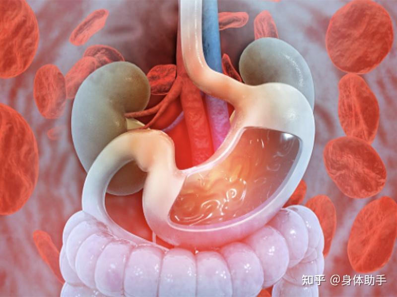 胃肠道出血有哪些症状 知乎