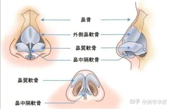 什么情况下可以选择鼻骨内推手术?