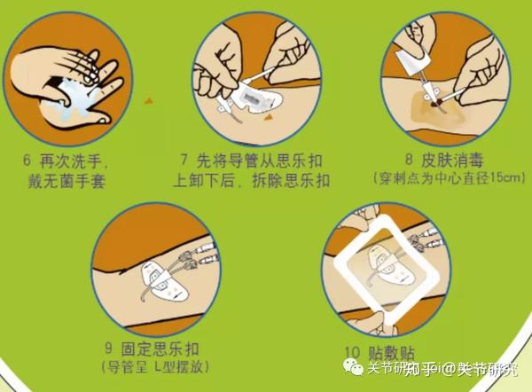 有放疗史的患者 picc注意事项 保持局部清洁,如果贴膜出现松动,污染