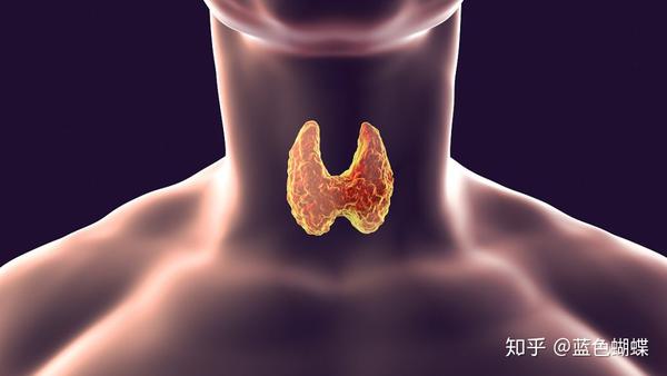 甲状腺结甲结节 zhuanlan.zhihu.com
