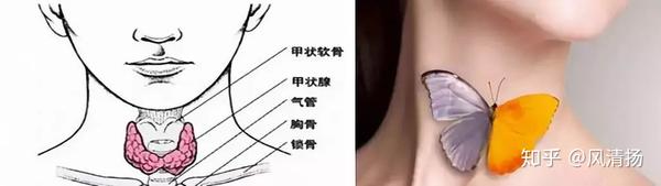 甲状腺位于人的气管两侧,甲状软骨下方,左右对称,中间以峡部相连,形似