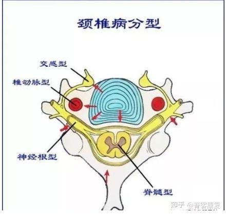 2,胸小肌紧张 (1)胸小肌位置