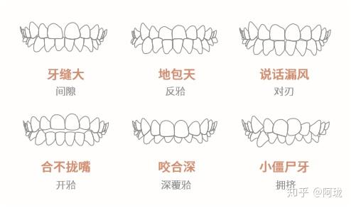 隐形牙齿矫正哪个机构比较靠谱