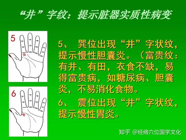 《七天学会手诊》八卦掌,疾病在手掌的对应分区