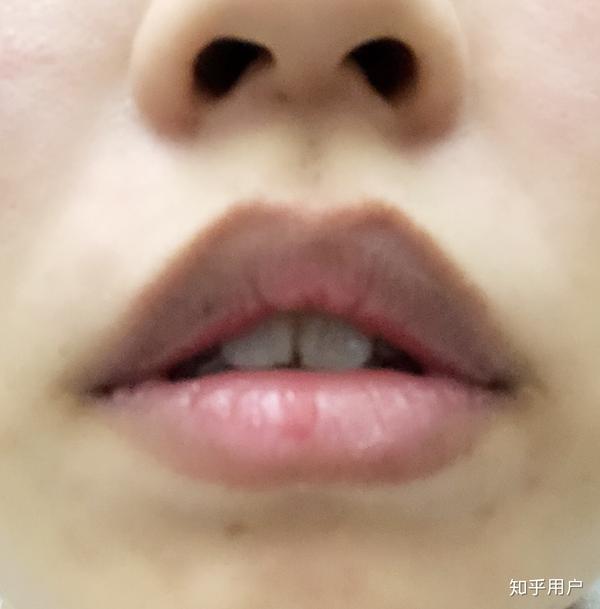 经常会注意自己有没有把嘴合上.然后就有人说我生气了 .