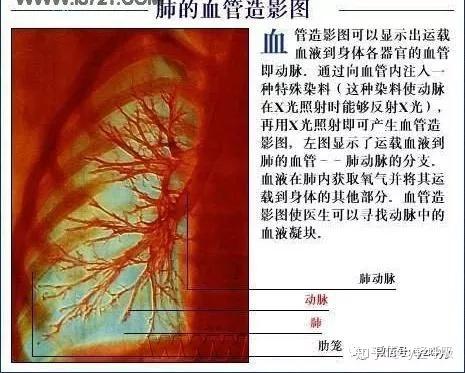 (3)肺血管病症