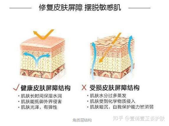 红血丝皮肤屏障受损多久能修复如何修复皮肤屏障受损