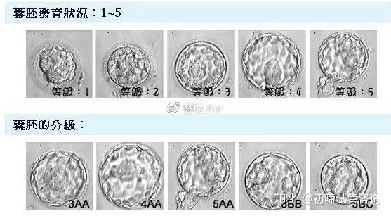 初啼健康:囊胚移植成功率到底有多高?揭秘囊胚移植的四大优点