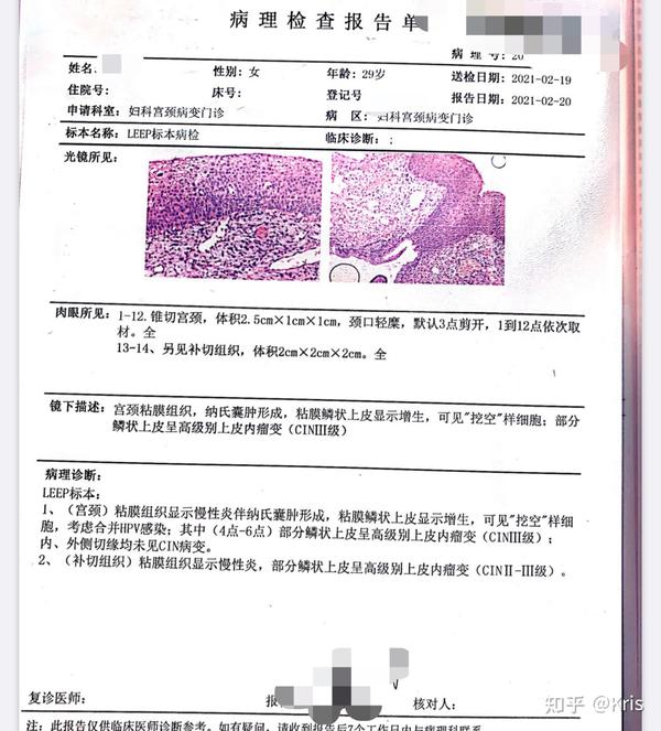 高危hpv感染到宫颈原位癌～姐妹,这篇宫颈癌前病变就诊实录你必须看!