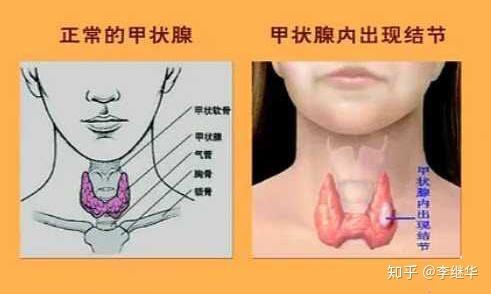 主要负责分泌甲状腺激素,维持人体的正常运转,对人体健康起着非常重要