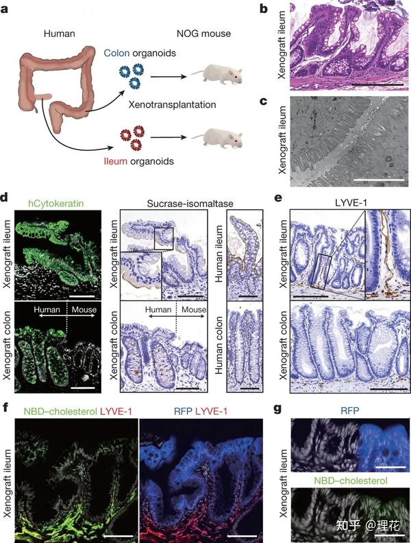 异种移植人回肠类器官重建小鼠结肠绒毛结构.