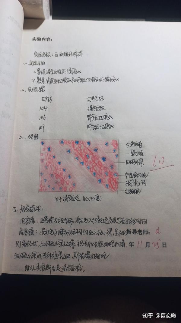 肝脂肪变性 肉芽组织 慢性肺淤血 混合血栓 炎细胞 肺结核肉芽肿