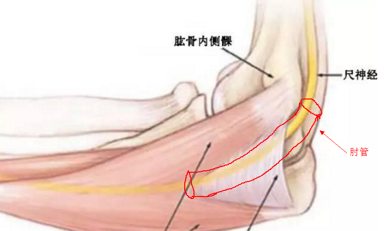 手部尺侧麻木疼痛怎么办?(肘管综合征是怎么回事?