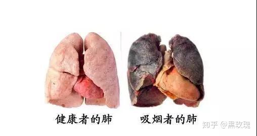长期吸烟太伤肺!