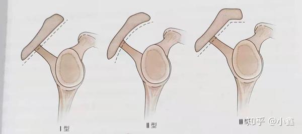 肩部复合体盂肱关节