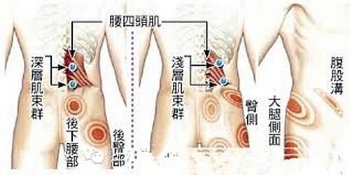 晨起或天气变化及受凉后症状加重,活动后则疼痛减轻,常反复发作.