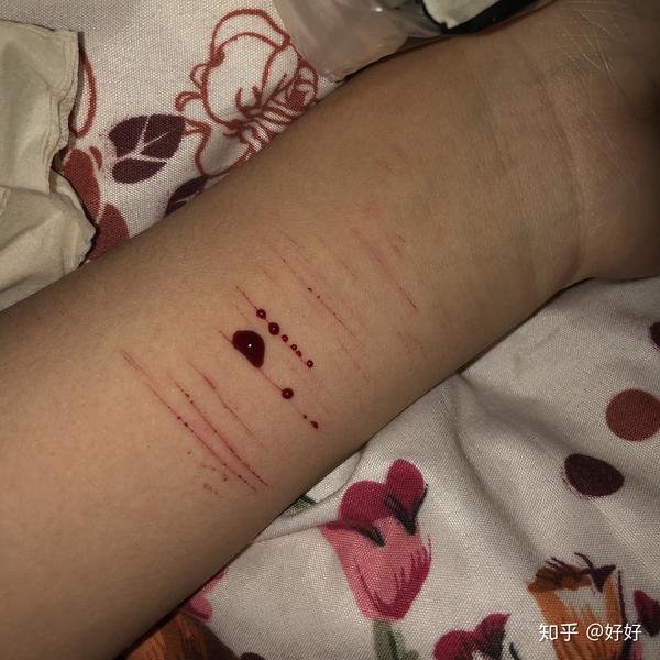 是不是自残过的人都会对自残上瘾,然后不管疼痛,不论伤疤,纵使知道会