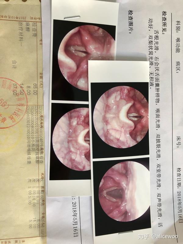 喉镜之前上网查了一下,看到那些个答案都吓得我要死,差点不敢去检查室