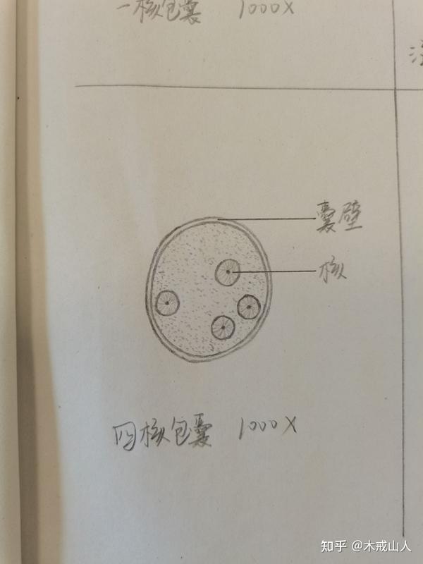 绦虫 四,叶足虫 溶组织内阿米巴包囊 五,鞭毛虫 六,孢子虫 间日疟原虫