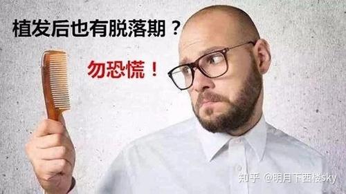 植发后还要经历脱落期?