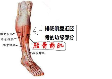 胫骨外旋,并且伴有足外翻,这种情况一般是因为小腿两侧肌肉张力不平衡