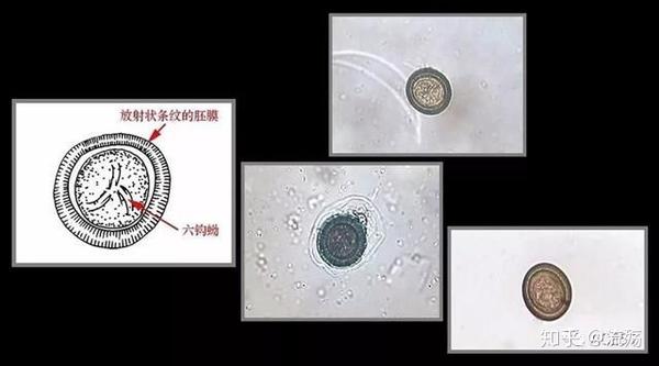 带绦虫卵