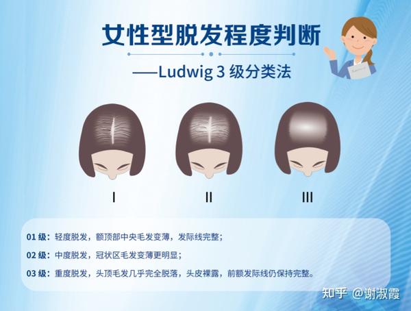 女性雄激素脱发的病情分级图(ludwig分级 )