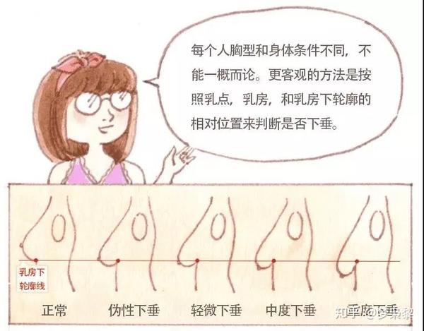 你到底是胸下垂还是胸下移?