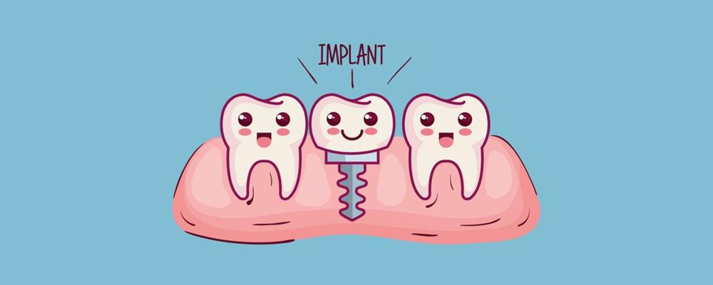 种植牙 —— 医学界推荐的修复方式