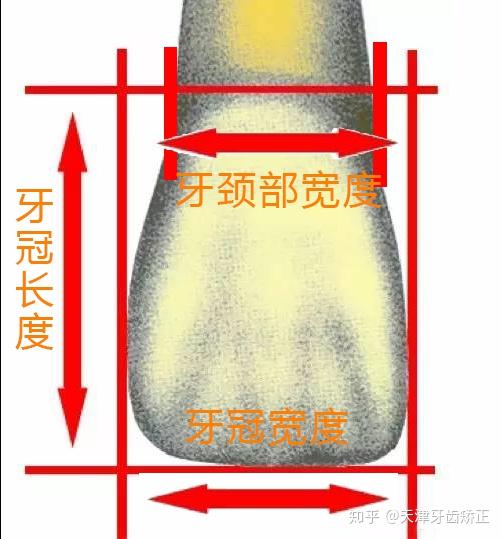 牙齿矫正中出现了黑三角怎么办