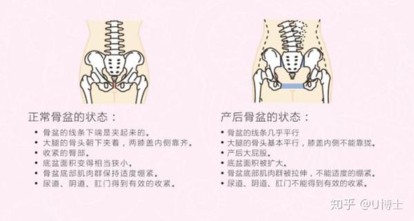 "别闹了好吗?你这是大屁股,不是蜜桃臀"产后盆骨修复很重要!