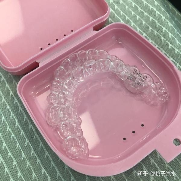 广州牙齿矫正关于保持器的使用方法