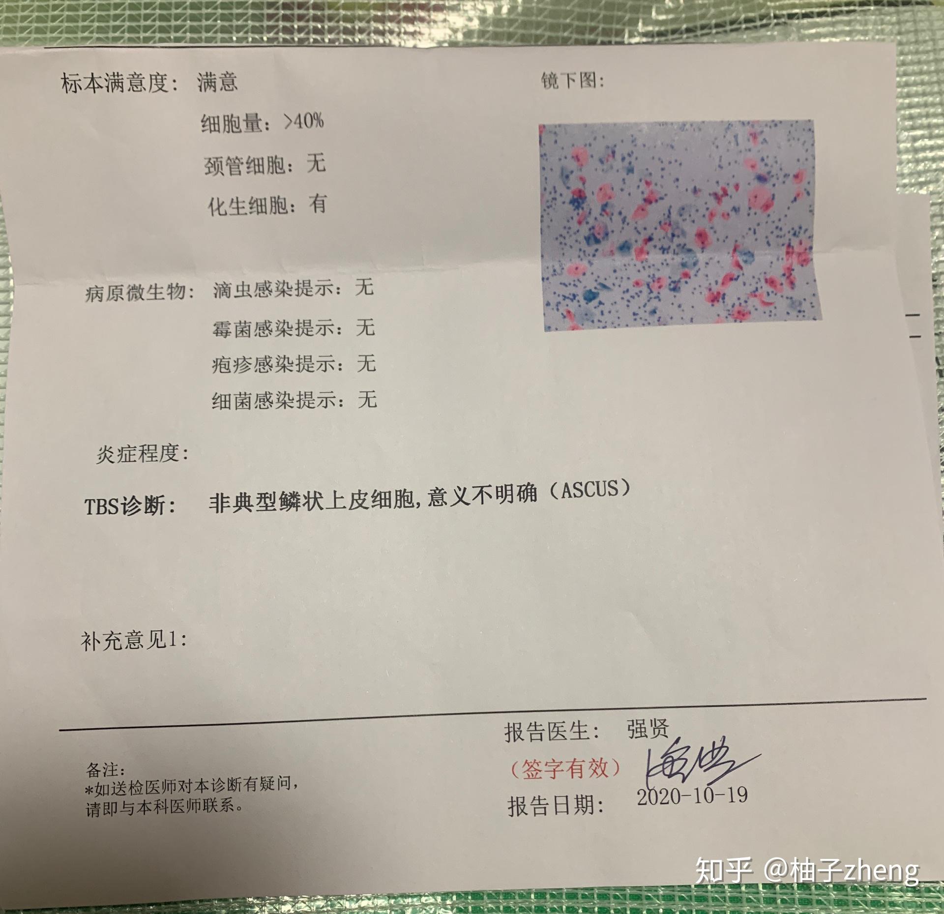 hpv高危58阳性,tct结果也不是很好,非典型领鳞状上皮细胞,意义不明确.