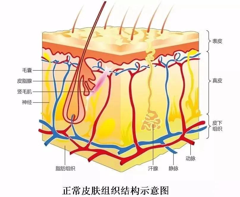 而我们人体皮肤分为表皮层和真皮层,一般当伤口的深度处于表皮层时不