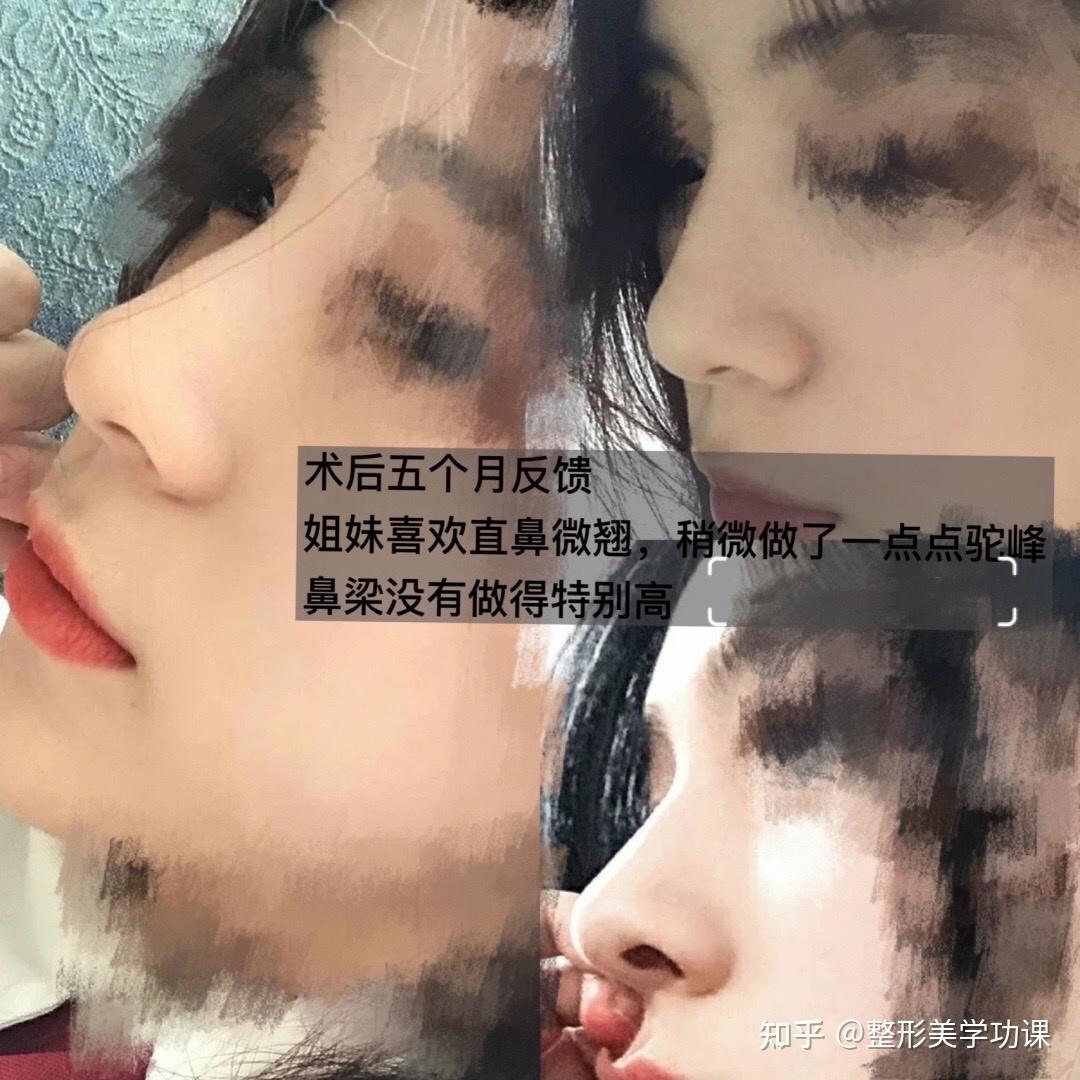 03鼻型审美直鼻微翘