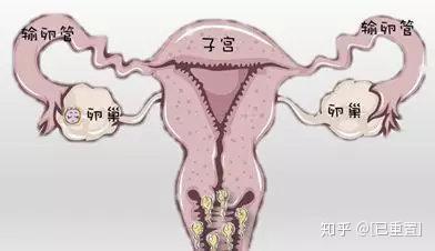 不孕不育与试管婴儿两者之间有何联系