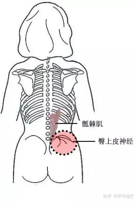 关于臀部痛点你知道多少分享关于臀部周围的5个常用痛点