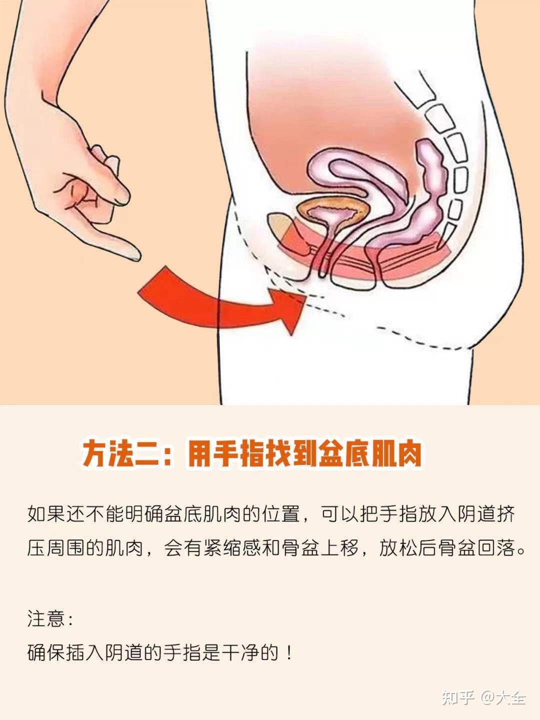 孕期产后修复|准妈必做凯格尔运动详解