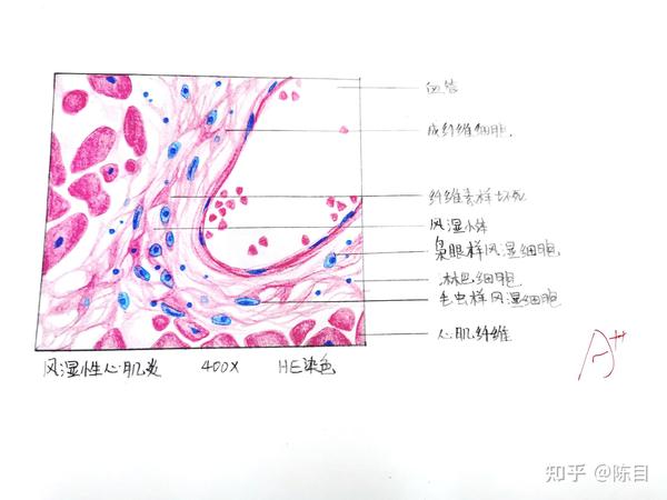 病理 红蓝铅笔绘图