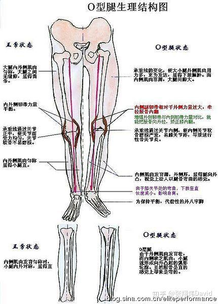 【o型腿的童鞋都来看一看,造成o型腿的原因是骨头还是韧带?