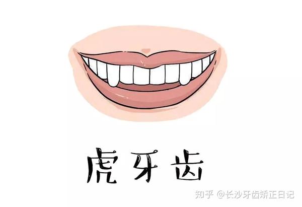 你的虎牙有给你颜值加分吗?