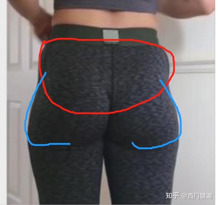 屁股臀部两侧凹陷是怎么回事