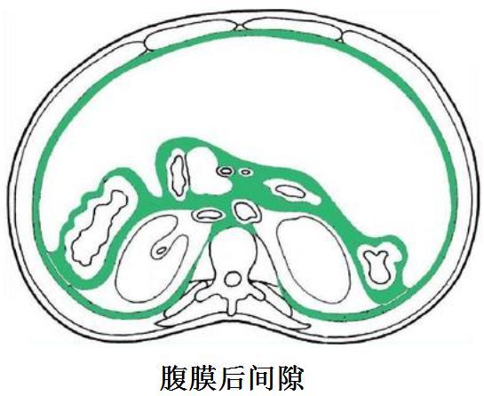 腹膜后肿瘤的腹腔热灌注如何杀死肿瘤细胞